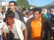 La Federación Internacional de Derechos Humanos condena que separatistas y racistas desaten ola de violencia en Bolivia