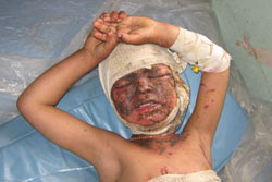 Más de 100 civiles afganos muertos por bombardeo de EE.UU.