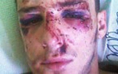 Policías dan golpiza a joven en San Rafael