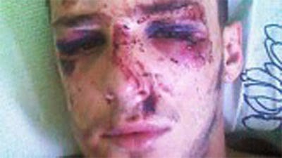 Policías dan golpiza a joven en San Rafael
