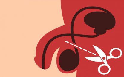 Vasectomía ¿por qué?