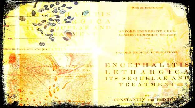 La Epidemia de Encefalitis Letárgica (1917-1928)