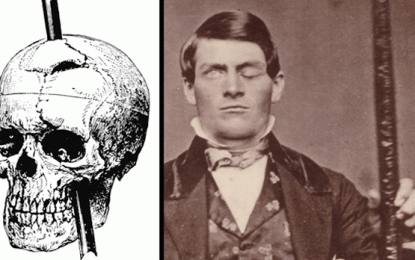 Orificios en el cerebro: el curioso caso de Phineas Gage
