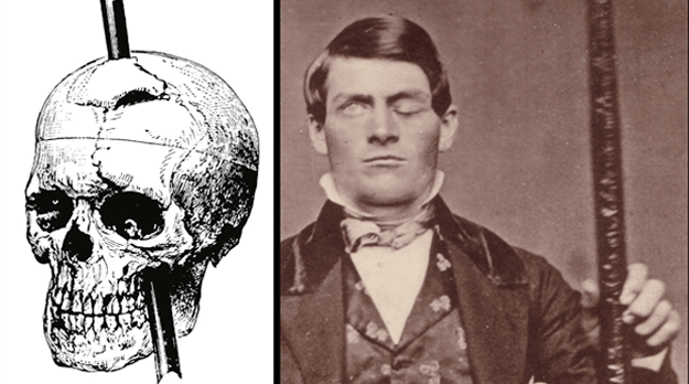 Orificios en el cerebro: el curioso caso de Phineas Gage